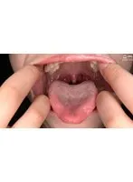AD-01381 -  