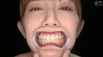AD-01421 -  [Teeth and oral fetish] Observation of the teeth, mouth, and uvula of a beautiful older sister with rare treatment marks! Saki Miizumi