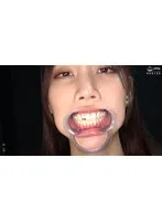 AD-01794 -  [Teeth/Mouth] A rare look at the oral cavity, uvula, and tongue of a popular actress who made her solo debut ★ Rara Shinosaki